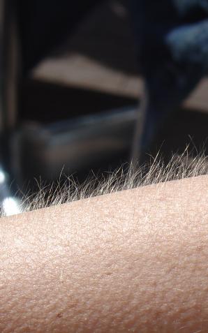 Jesienno-zimowe kłopoty ze skórą